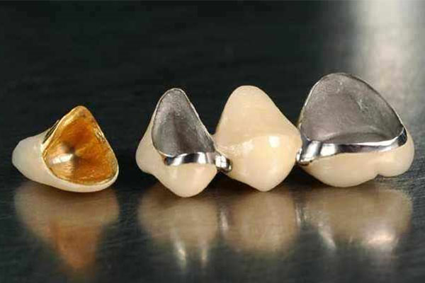 几百元烤瓷牙能用多久？中老年口腔