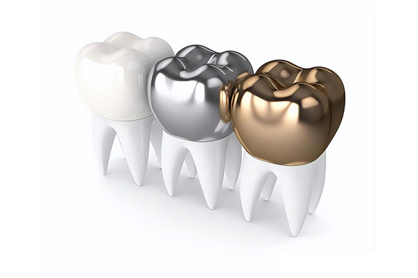 大牙掉了，中老年口腔种牙轻松解决