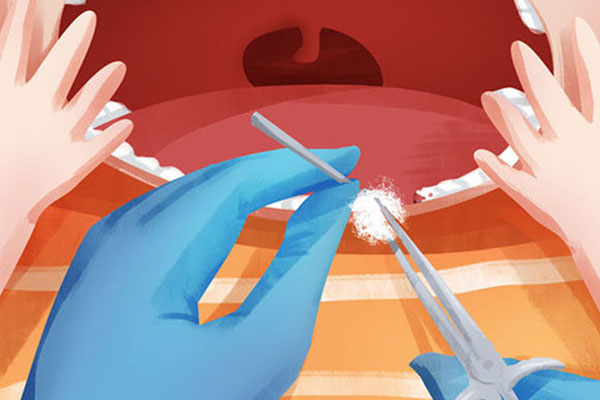 老年人洗牙用盐水泡有效吗？中老年