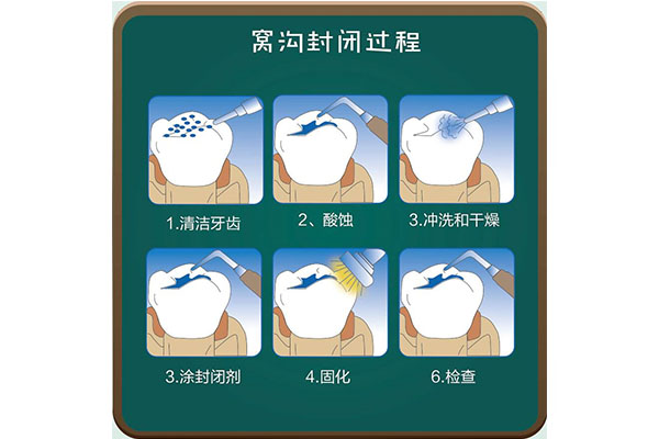 孩子牙齿涂氟有必要吗？中老年口腔