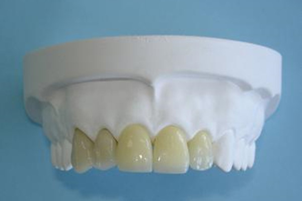 戴活动假牙的注意事项和禁忌，中老年口腔专家为您解答