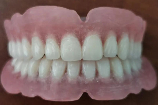 不用等！中老年口腔即刻义齿当天戴