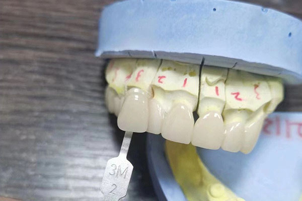 中老年口腔揭秘：义齿加工厂7步标准