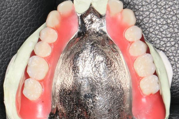 活动义齿松了怎么办？中老年口腔为