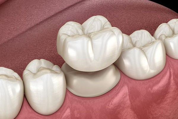 补牙后咬不了硬东西怎么办？中老年