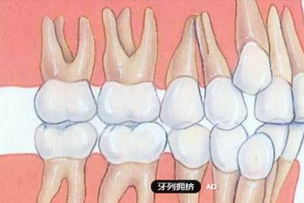 牙齿松动是怎么回事？中老年口腔快