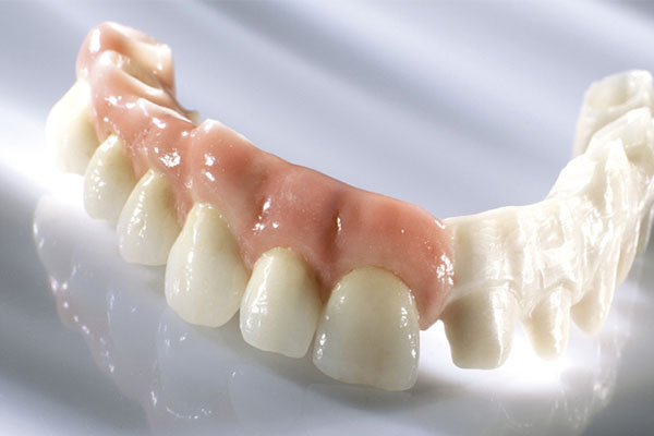 中老年口腔：做活动假牙多少钱？一