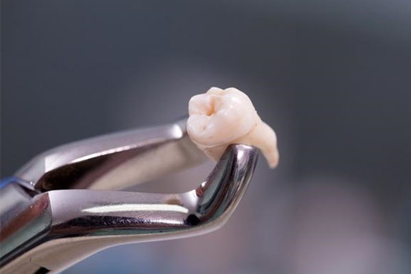 智齿顶坏牙怎么办？中老年口腔为您轻松解决！