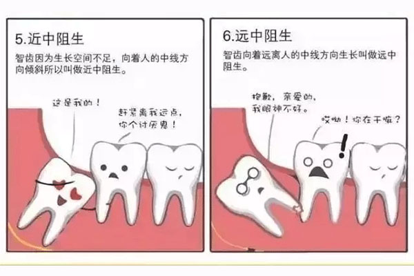 二甲医院拔智齿多少钱一颗？中老年口腔批量高效解决缺牙烦恼
