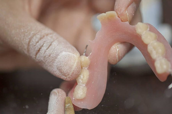 中老年口腔：装活动假牙的过程全解析，缺牙不再困扰！