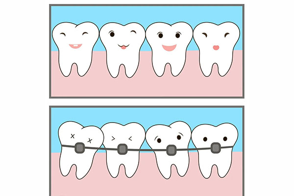 中老年口腔：正畸扩弓标准，快速解决牙齿松动与缺牙问题