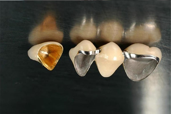 树脂基托总变形？5大原因揭秘及中老