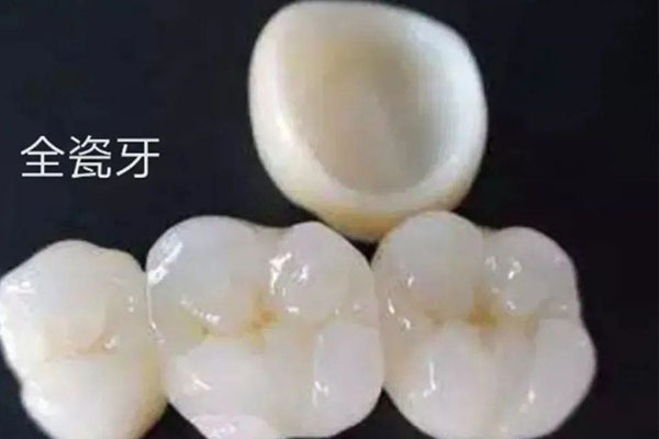 乐瓷全瓷牙：中老年人的高效缺牙修