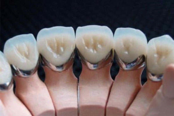 活动假牙多少钱合理又耐用？中老年