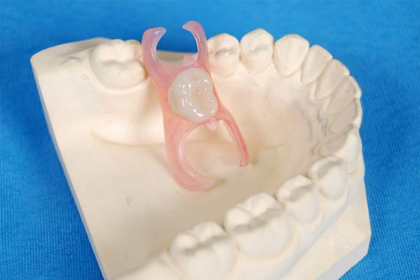 可摘局部义齿的结构解析：中老年口腔专家详解四部分组成