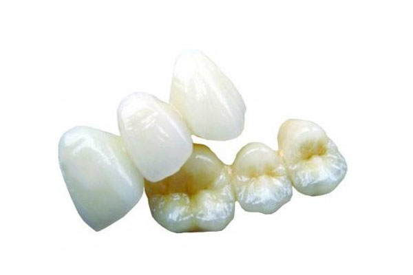连掉3颗牙能做全瓷牙吗？中老年口腔