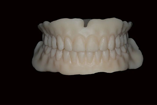 活动假牙安装原理揭秘：中老年口腔如何实现高效缺牙修复？