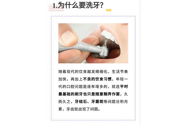 北京医院洗牙多少钱一次？中老年口