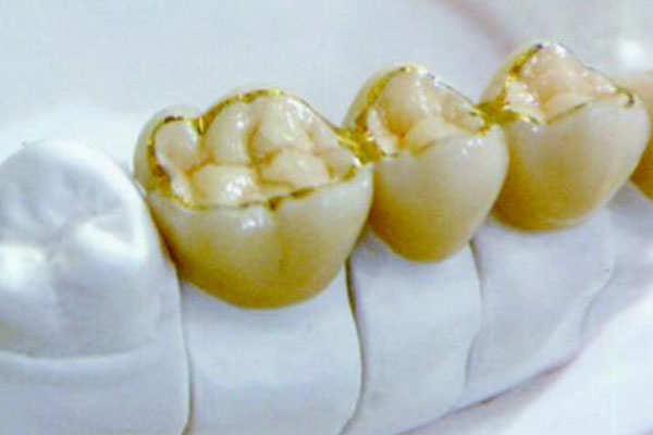 活动假牙每晚必须摘下来吗？中老年