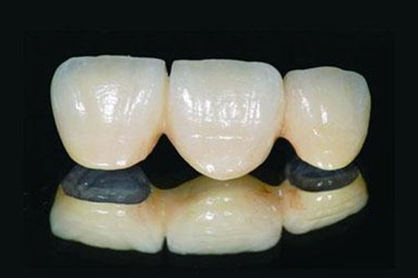 广东镶牙多少钱？中老年口腔批量高