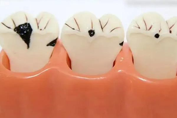 中老年牙疼怎么办？推荐这批高效药