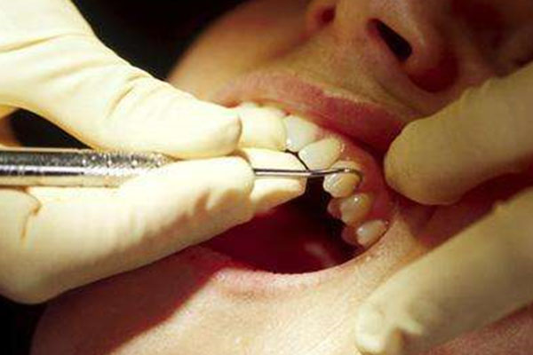 牙齿脱落不用愁，中老年口腔批量修复方案让笑容更自信