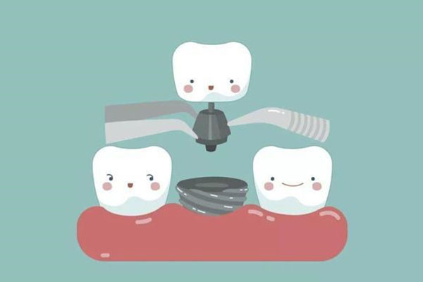 种牙做一颗烤瓷牙多少钱？中老年口腔批量种牙效率高更省钱