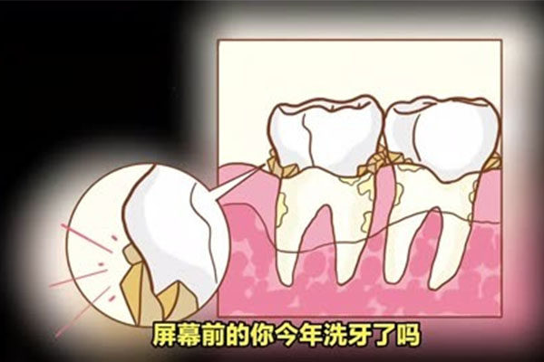 牙科洗牙贵吗多少钱？中老年口腔批