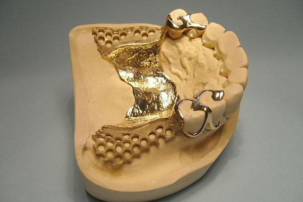 中老年口腔：义齿哪个部门最挣钱？高效解决牙齿缺失的秘密