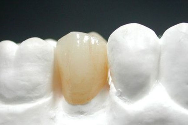 牙齿重生不是梦！中老年口腔揭秘国产二氧化锆全瓷牙5年临床验