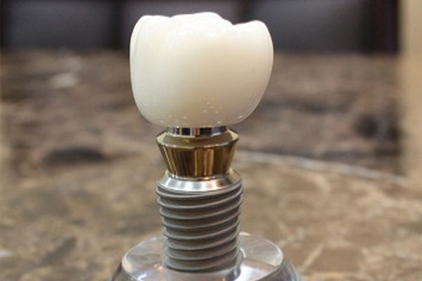 中老年缺牙困扰多，吸附性义齿与种牙到底怎么选？