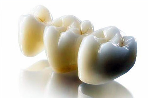 中老年口腔专家提醒：安装牙冠后不