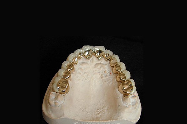 中老年口腔｜吸附性义齿适应症VS禁忌症：批量高效修复，一文