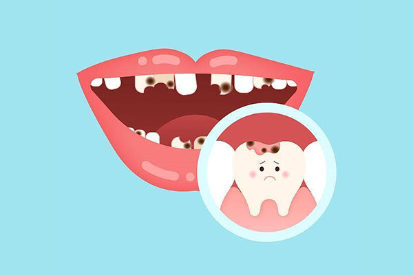 中老年人蛀牙到底补不补？效率批量修复缺牙难题