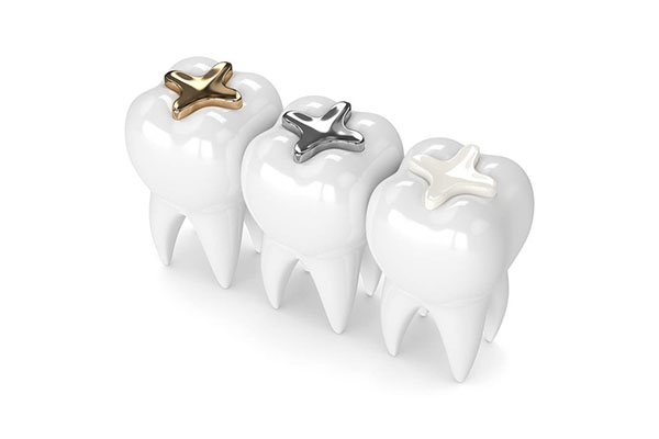 补牙最后一步需要多长时间？中老年