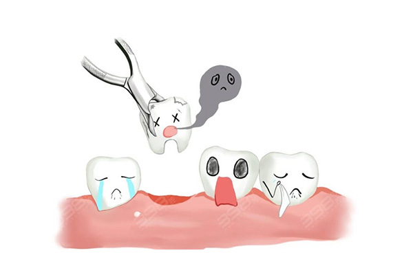 阻生智齿拔牙多久能结束？中老年口