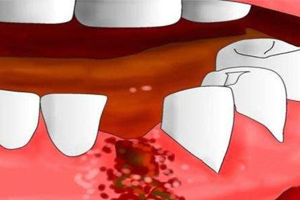 乳牙不脱落的原因及解决办法，中老年口腔专家为您详细解析