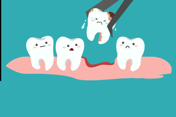 下智齿拔掉多少钱一颗？中老年口腔