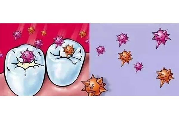 5岁孩子蛀牙最简单处理方法，中老年口腔为您解决！