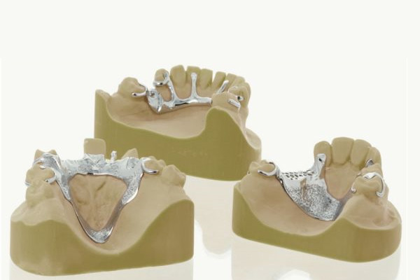 单侧活动义齿设计难题破解！爸妈缺牙一招轻松解决，中老年口