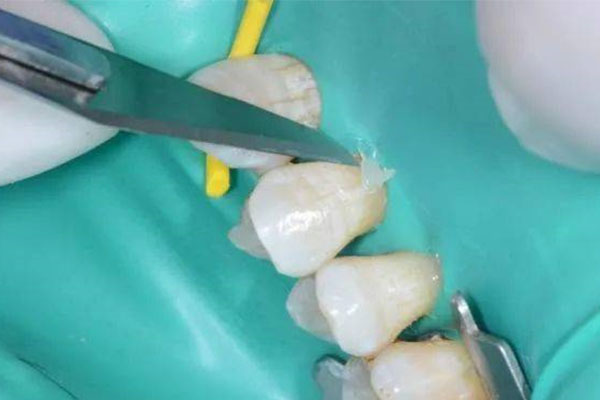 孩子乳牙未松新牙已萌发必须拔吗？中老年口腔专家揭秘儿童换