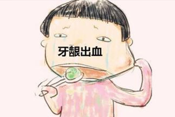 刷牙时老是出血是什么原因止牙出血牙膏