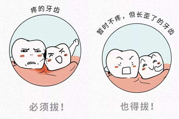 儿童牙齿封沟好不好拔(儿童牙齿封沟好不好拔牙)