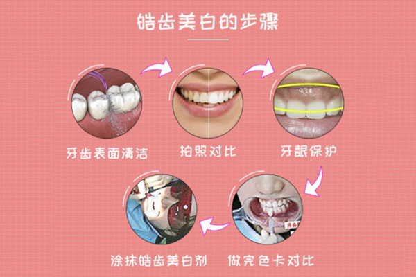 牙齿很黄很多烟渍怎么搞(牙齿很黄很