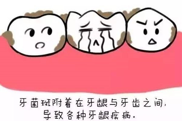 刷牙时牙龈出血是因为什么