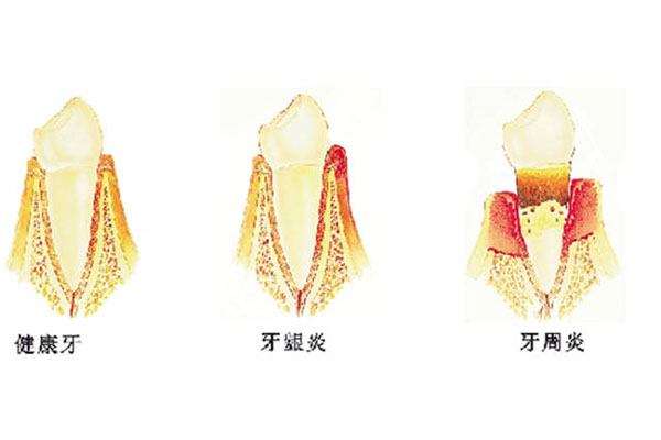 北京口腔牙周科(北京口腔牙周科刘静)