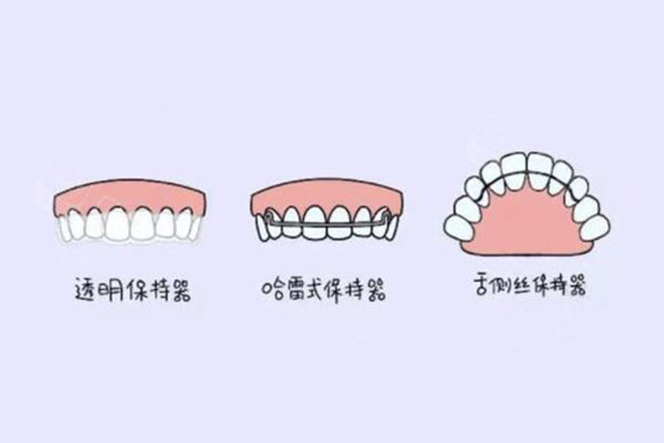 30岁以后还能做牙齿矫正吗(30岁以后还能做牙齿矫正吗女)