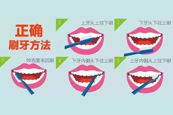 医生为什么不建议洗牙的后果