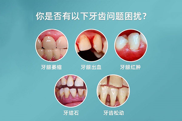 年龄大了牙龈萎缩怎么办(年龄大了牙龈萎缩怎么办图片)