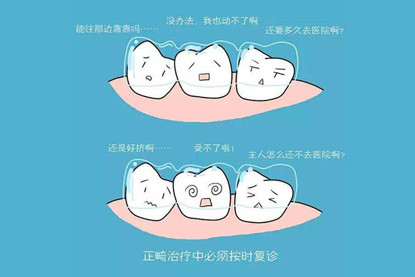 龅牙带牙套可以改变脸型吗(龅牙 戴牙套)